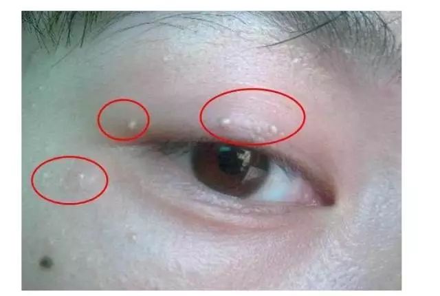 一旦眼睛出现这8种症状要当心,这可能是大病的征兆