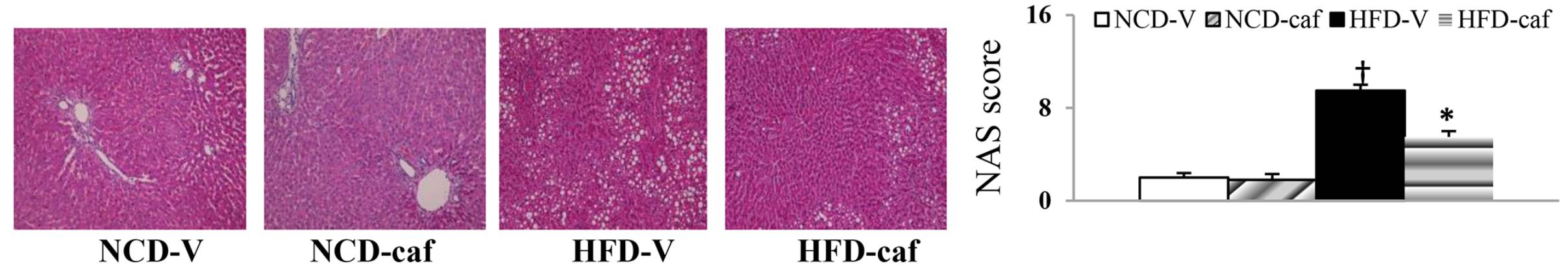 fig.1 小鼠肝脏he切片及nash活动度评分