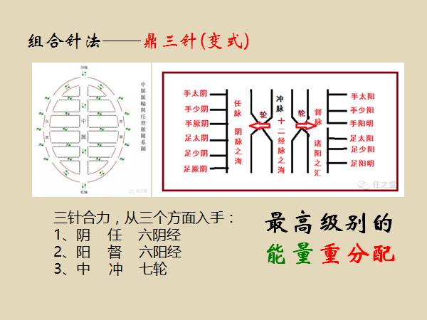 阴阳九针组合针法之鼎三针