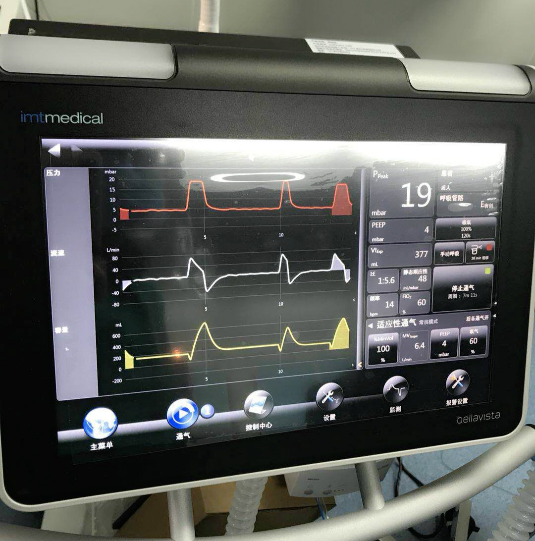 麻醉科采用靶控输注(tci)全凭静脉麻醉,辅用瑞士高端智能贝斯特呼吸机