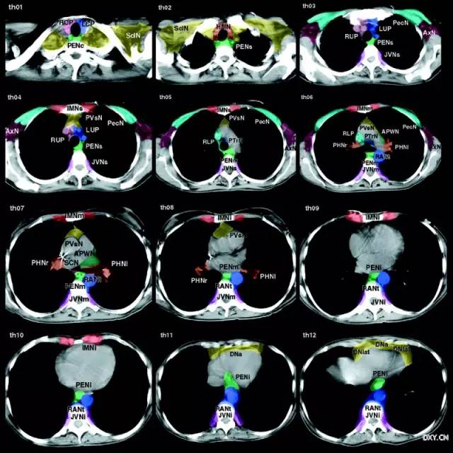 肿瘤医生必看:全身各区域淋巴结 ct 图谱