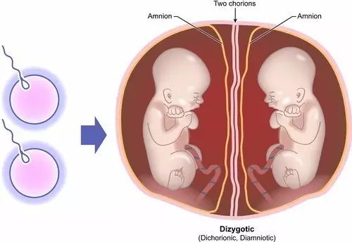 rcog:单绒毛膜双胎处理指南 (2016) 要点解读 (一)