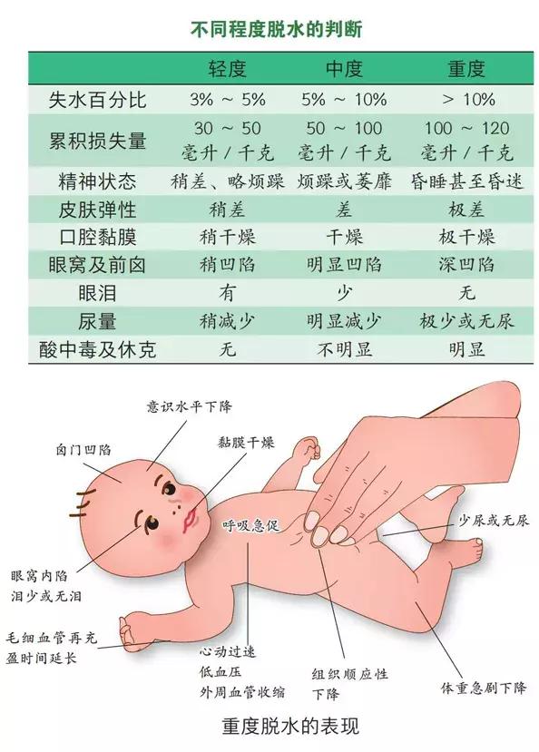 脱水症状