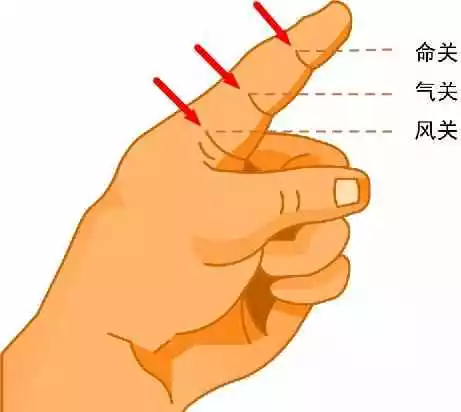 正常小儿指纹多数为红黄隐隐在风关之内,若发生疾病,指纹的显露则发生