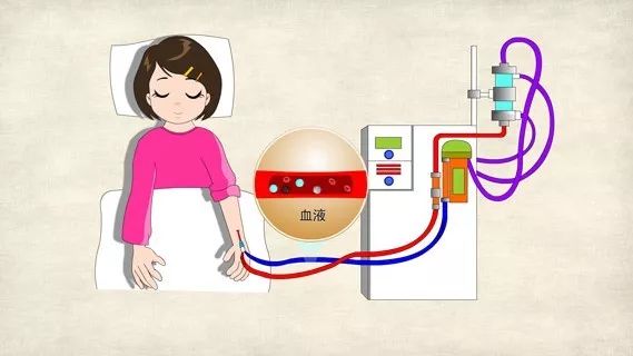 化疗后引起的 mtx 排泄延迟的治疗, 过去可采用血液净化(如血液透析