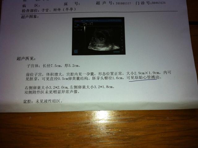 母婴 正文  9月19日该来月经的时候出了点褐色分泌物,三天就没有了,也
