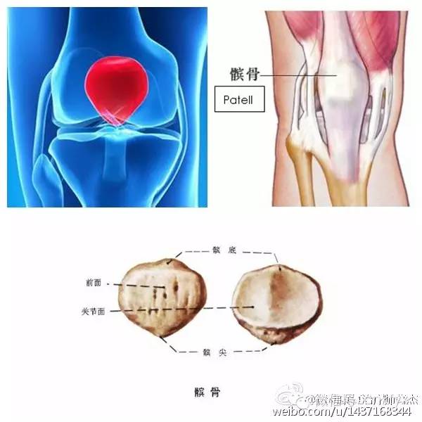 髌骨松动术对于膝关节活动度恢复意义重大