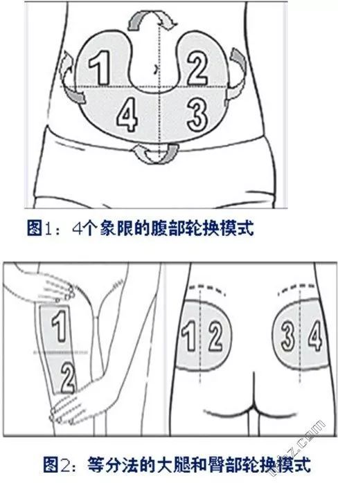 注射胰岛素的正确位置 正确的做法是将腹部分为4个等分区域,大腿或