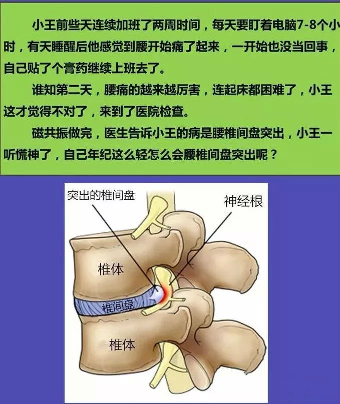 什么是腰椎间盘突出症呢?