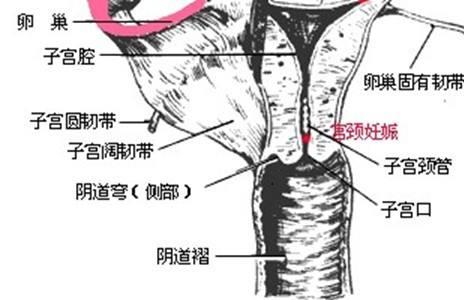 人口造影_输卵管造影图片