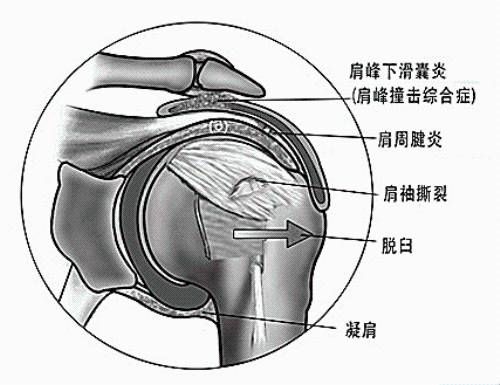 十什么如椎成语_成语故事图片(3)