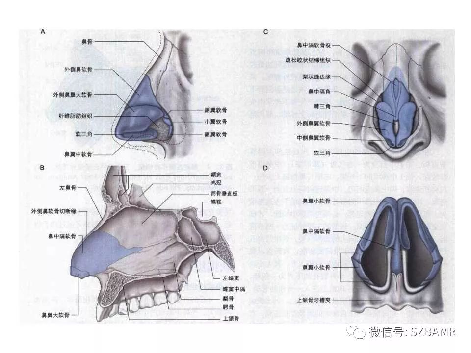 鼻腔鼻窦解剖及常见病变影像诊断一