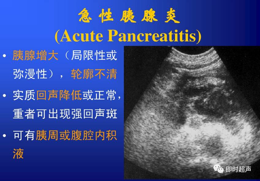 胆道及胰腺超声检查