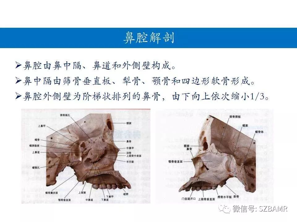 鼻腔鼻窦解剖及常见病变影像诊断(一)