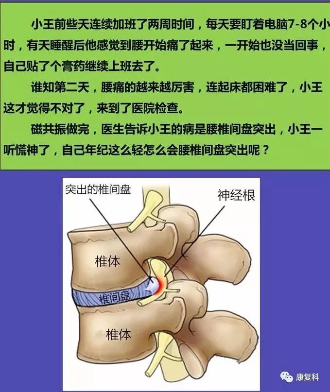 一图读懂腰椎间盘突出【图文】