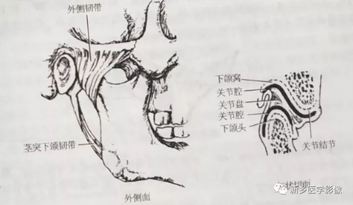 1 颞下颌关节 组成:由下颌骨的下颌头与颞骨的下颌窝及关节结节构成