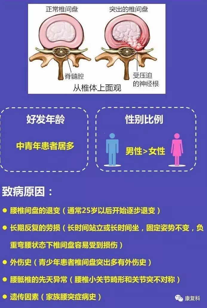 一图读懂腰椎间盘突出图文