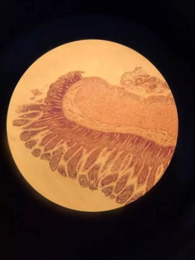 粘膜有许多绒毛,绒毛根部的上皮下陷至固有层,形成管状的肠腺,其开口