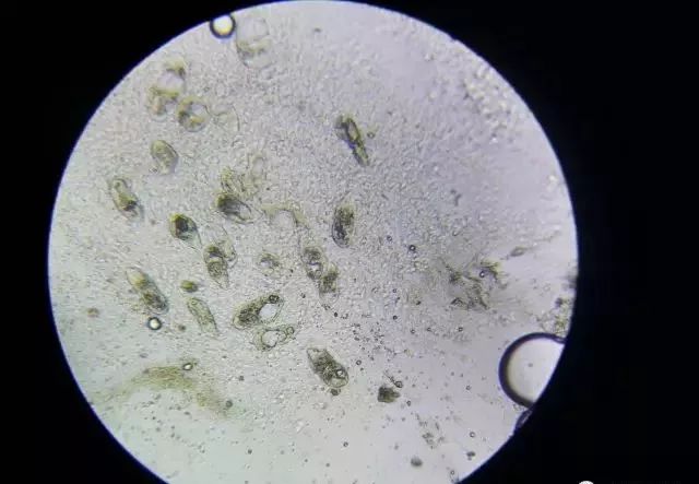 那些看不见的"虫"在显微镜下是如何入侵鱼虾的!