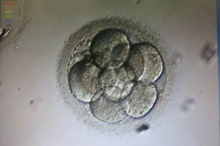 第三天胚胎