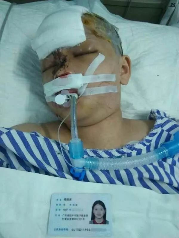 募捐龙潭村这名21岁女子因车祸重伤急需救治