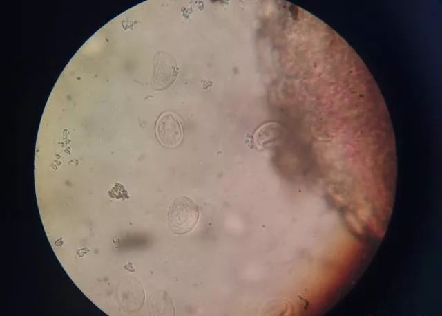 那些看不见的虫在显微镜下是如何入侵鱼虾的