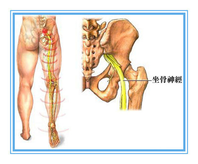 下面为大家介绍腰间盘突出症的锻炼方法,希望能对