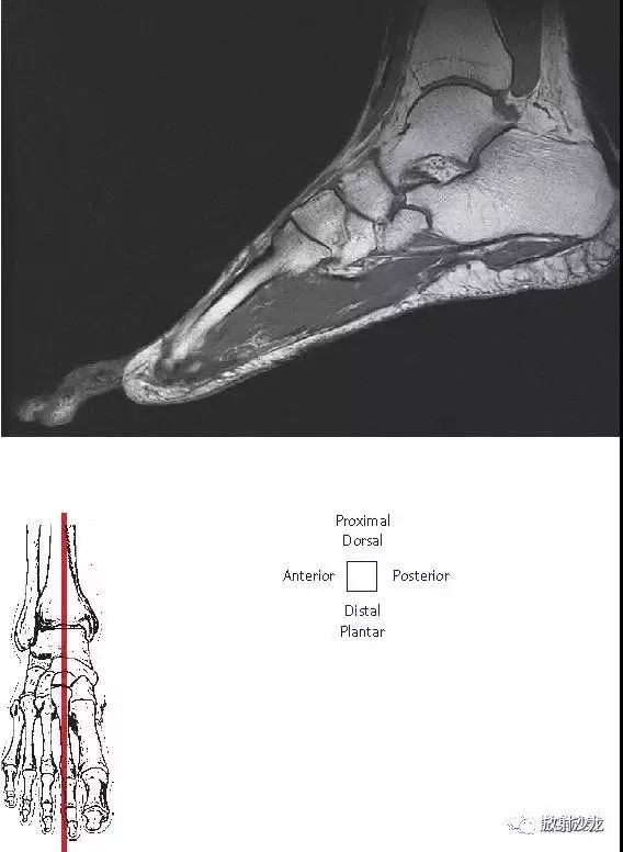 【解剖】踝关节系统解剖图 冠/矢/轴mri