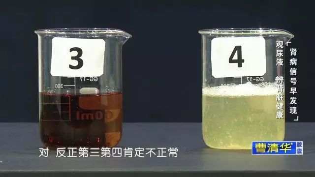 4号 泡沫尿