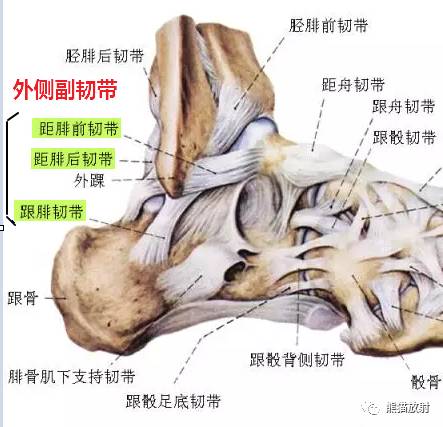 篮球运动员运动损伤中 53 是踝关节外侧副韧带的损伤;足球运动员