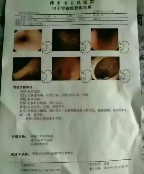 【炎干净】胃病患者服用之后