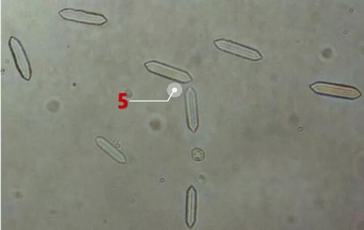 钟形虫 2班氏丝虫微丝蚴 3肾小管上皮细胞管型 4巴贝斯虫 5马尿酸结晶