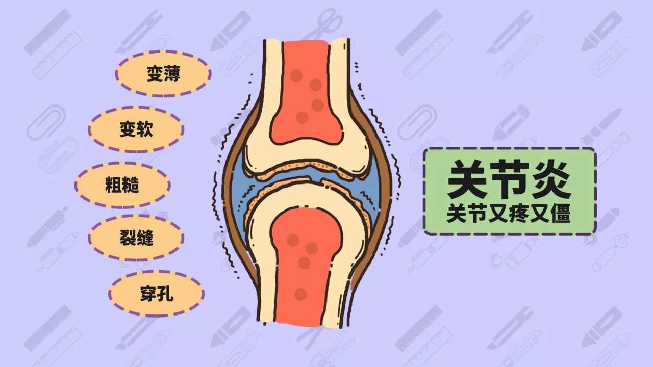 常常因为关节炎饱受欺凌膝盖这个大关节这就是我们常说的关节炎关节又