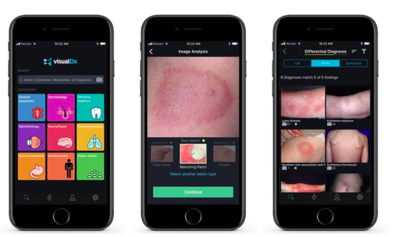国际妹 | 十秒检测癌症的"笔"和靠图片诊断皮肤病的app 哪个更牛?