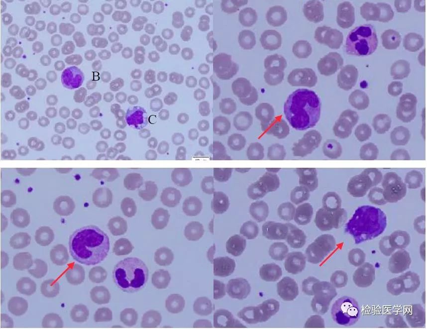 单核细胞-外周血中的百变咖