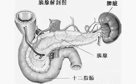 为她顺利保下了脾脏----记"保留脾脏的全胰腺十二指肠切除术"