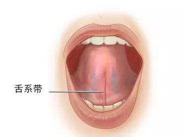 健康 正文  舌系(xì)带就是我们平时说的舌筋,张开嘴翘起舌头时候能