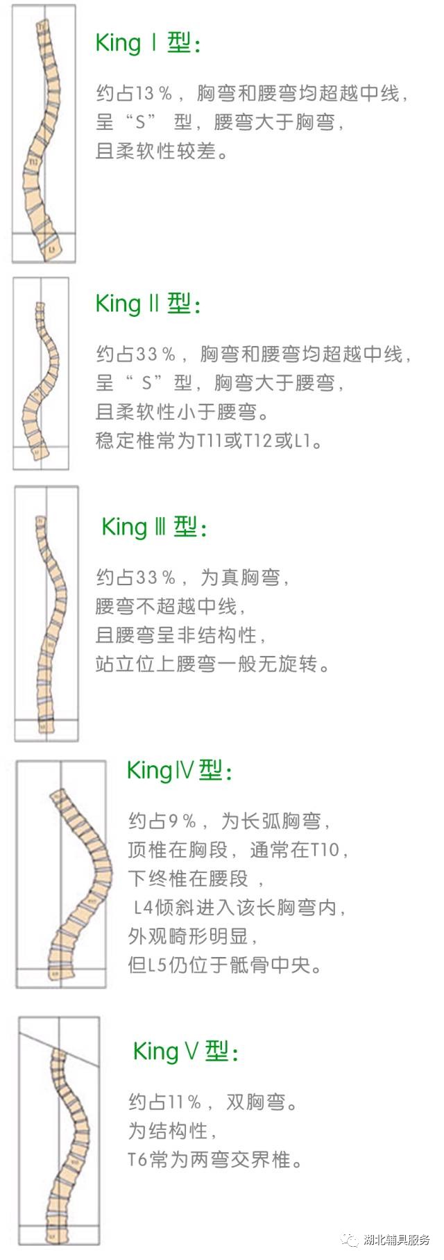 脊柱侧弯的早期征象和形状类型