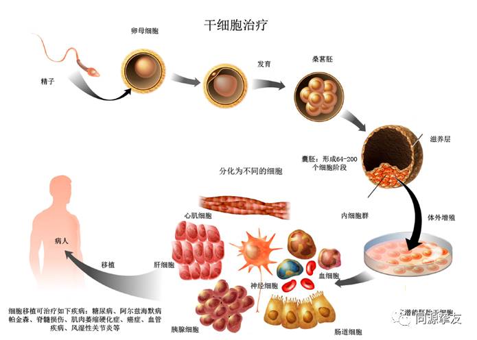 骨髓可以促进干细胞再生新细胞,修复器官,让慢性病慢慢恢复,从根本上