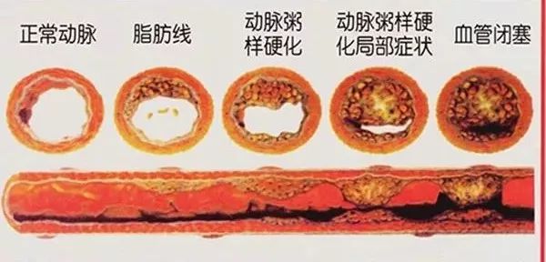 血管的"清洁工"原来是它,每天吃两口,血管干净了,疾病