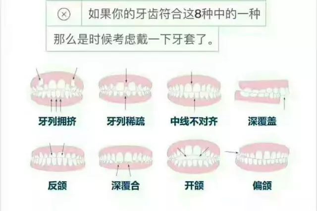 矫正牙齿有年龄限制?