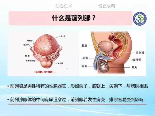 健康零距离尿频尿急一一前列腺增生该如何治疗