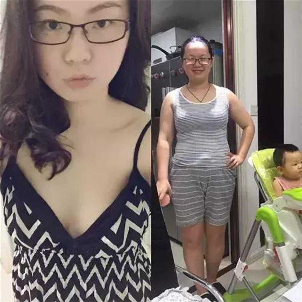 女人生过孩子,肚子就像瘪了皮球,堆堆褶还没有弹性;生孩子以前脸上