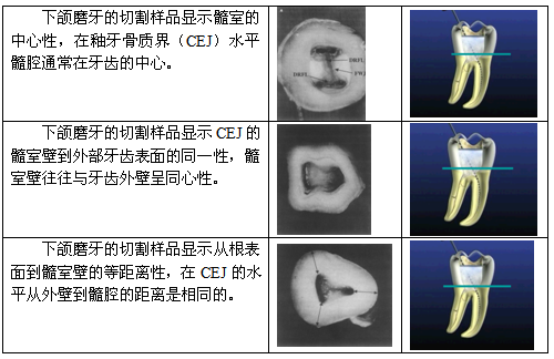 4)结论 中心法则:髓室底通常位于釉牙骨质界水平的牙齿的中心.