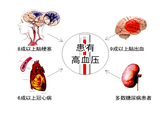 高血压不降不稳,小心脑梗心梗,让血压稳如山可以这样做