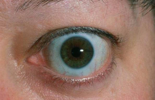 眼睛出现这三种情况,是疾病来临给你的信号,再不注意就晚了