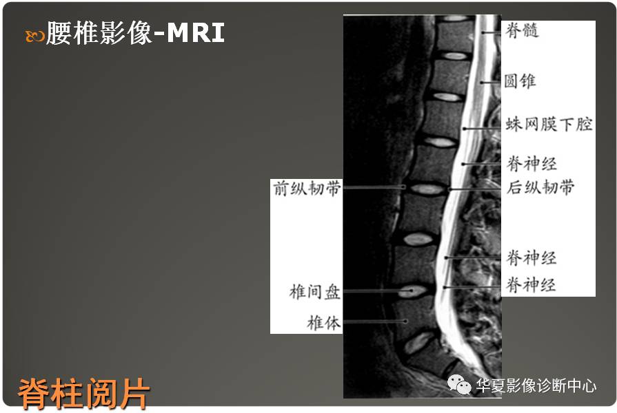 脊柱解剖及阅片基础