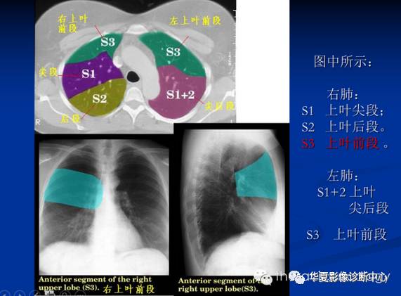 最详尽的图文解说:肺的分段解剖