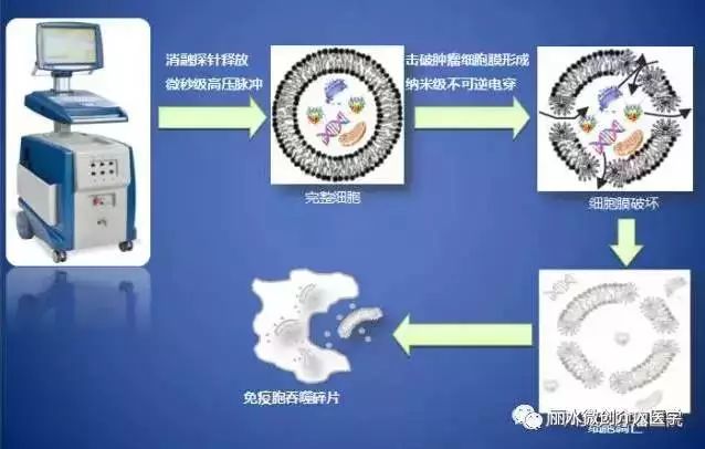 科技 正文  纳米刀是近年来兴起的一种最新型肿瘤消融技术.