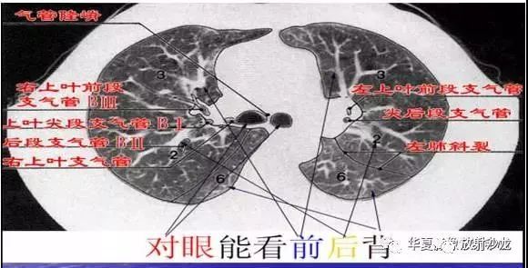 最详尽的图文解说肺的分段解剖